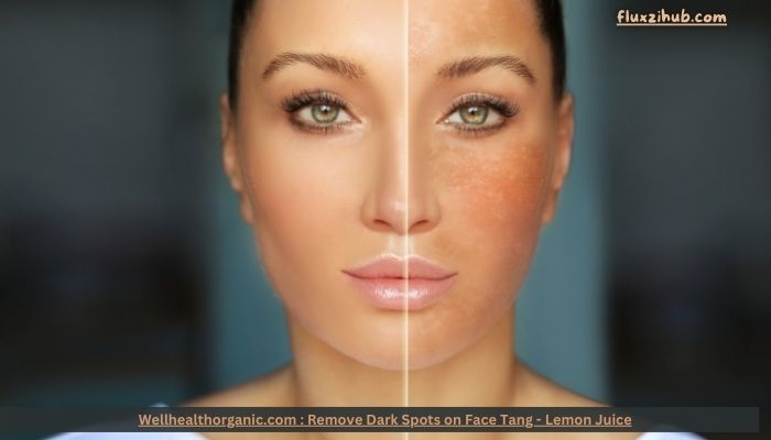 Wellhealthorganic.com : Remove Dark Spots on Face Tang – Lemon Juice